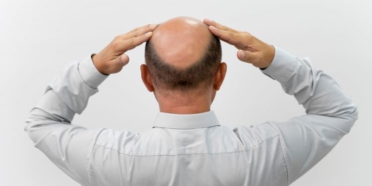 ยาปลูกผม ยี่ห้อไหนดี - 1