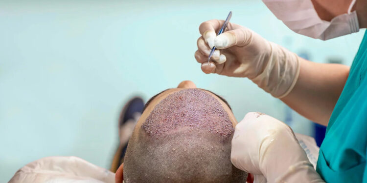 คลินิกปลูกผม เชียงใหม่ ที่ไหนดี - 1